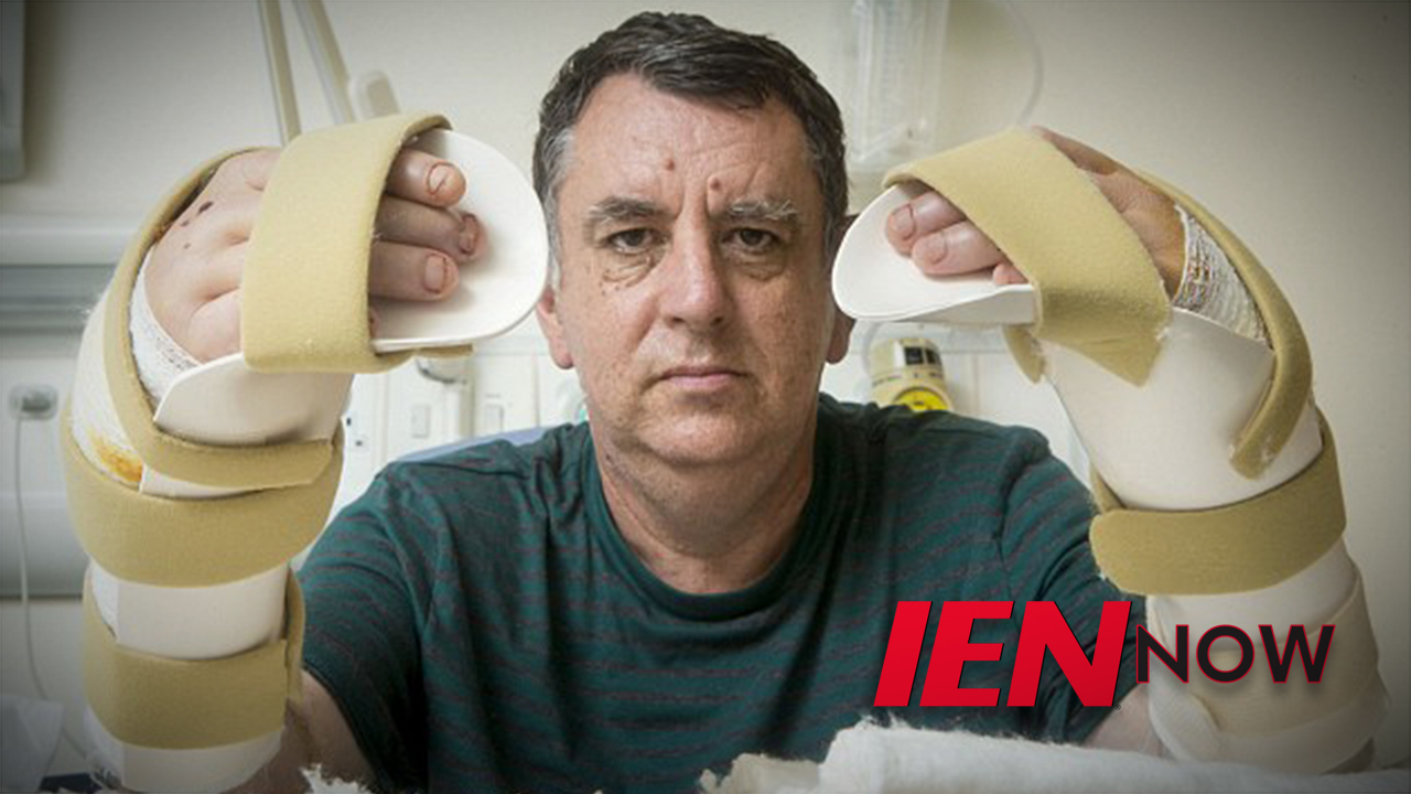 IEN Now: Man Gets Two New Hands After Industrial Accident