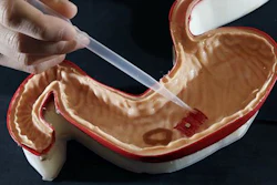 In this July 13, 2016 photo, Steven Guitron, a mechanical engineering masters student at the Massachusetts Institute of Technology, points a pipette at a tiny 'origami robot' floating toward a 'wound' in a stomach model in Cambridge, Mass. Guitron, and others at MIT have developed these tiny ingestible robots which are 'folded up' - hence the name - and swallowed in order to complete certain tasks within the body.