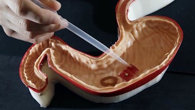 In this July 13, 2016 photo, Steven Guitron, a mechanical engineering masters student at the Massachusetts Institute of Technology, points a pipette at a tiny 'origami robot' floating toward a 'wound' in a stomach model in Cambridge, Mass. Guitron, and others at MIT have developed these tiny ingestible robots which are 'folded up' - hence the name - and swallowed in order to complete certain tasks within the body.