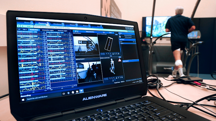A computer screen shows sensor readouts of David Moran running on a treadmill. The Michigan Performance Research Laboratory, which is part of the School of Kinesiology, is offering runners an in-depth assessment designed to help them improve their form.