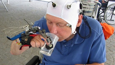 Scientists have developed a mind-controlled robotic hand that allows people with certain types of spinal injuries to perform everyday tasks such as using a fork or drinking from a cup.