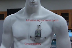 Researchers from North Carolina State University have developed a wearable, wireless sensor that can monitor a person's skin hydration to detect dehydration before it poses a health problem. The device is lightweight, flexible and stretchable and has already been incorporated into prototype devices that can be worn on the wrist or as a chest patch (as seen here).