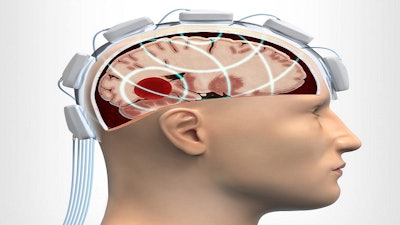 Individual antennas in the system transmit, in sequence, a weak microwave signals through the brain, while other receiving antennas measure the reflected signals. Distinct structures and substances in the brain affect the microwave scattering and reflections in different ways and the received signals provides a complex pattern, as interpreted by using advanced algorithms.