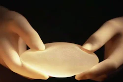 Breast Implant 58d27dfee0496