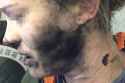 On a recent flight from Beijing to Melbourne, a passenger was listening to music using a pair of her own battery-operated headphones. About two hours into the flight, the passenger heard a loud explosion.