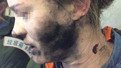 On a recent flight from Beijing to Melbourne, a passenger was listening to music using a pair of her own battery-operated headphones. About two hours into the flight, the passenger heard a loud explosion.