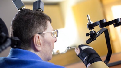 In this undated photo made available on Tuesday, March 28, 2017 by Case Western Reserve University, Bill Kochevar feeds himself, in Cleveland, Ohio. A paralyzed man was able to feed himself for the first time in eight years, after doctors implanted electronic sensors into his brain and arm that restored the broken connection between them. Kochevar, 56, was paralyzed from the shoulders down after a cycling accident in Cleveland nearly a decade ago.