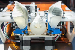 This robotic sonar head mimics the emission and reception dynamics of the horseshoe bat, which uses small movements of the ears and noseleaf to encode extra information in sonar pulses.