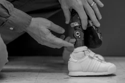 A high-tech prosthesis for a child draws on decades of research.