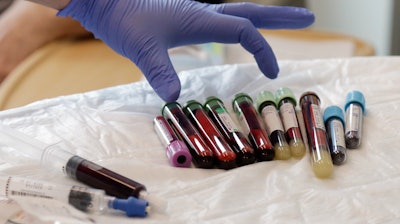 In this photo taken March 21, 2017, a nurse reaches for blood samples taken from a patient receiving a kind of immunotherapy known as CAR-T cell therapy at the Fred Hutchinson Cancer Research Center in Seattle. Immune therapy is the hottest trend in cancer care and its next frontier is creating 'living drugs' that grow inside the body into an army that seeks and destroys tumors.