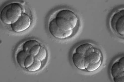 In this microscope photo provided by Oregon Health & Science University, human embryos grow in a laboratory for a few days after researchers used gene editing technology to successfully repair a heart disease-causing genetic mutation. The work, a scientific first led by researchers at Oregon Health & Science University, marks a step toward one day preventing babies from inheriting diseases that run in the family.
