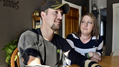 In this Feb. 25, 2014, photo, Little Falls, Minn., resident Jamie Houdek, with his wife, Lisa, at his side, talks about his recovery after he lost his right hand to a corn picker in November 2013 on the 60-acre hobby farm where he raises beef cattle. The nation’s growing embrace of small-scale production of local and organic crops is leading to more farm injuries and deaths among amateur growers. Experts say some novices have little appreciation of the occupation’s dangers.