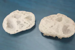 This is a 3D model of a children's heart.