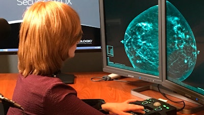 In this Nov. 21, 2017 photo provided by the Montefiore Health System, Dr. Tova Koenigsberg at The Montefiore Einstein Center for Cancer Care in New York shows an example of a traditional mammogram scan. U.S. health officials are beginning a huge study to compare traditional mammograms with 3-D versions, to see if the newer choice might really improve screening for breast cancer.