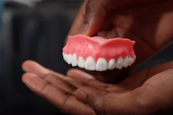 The dentures are printed using acrylamide, the current go-to material for denture fabrication.