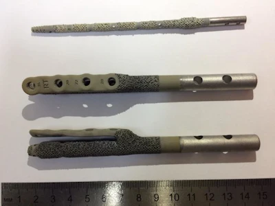 These are implants with an applied coating developed at Tomsk Polytechnic University.