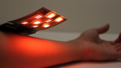 A new sensor made of an alternating array of printed light-emitting diodes and photodetectors can detect blood-oxygen levels anywhere in the body. The sensor shines red and infrared light into the skin and detects the ratio of light that is reflected back.