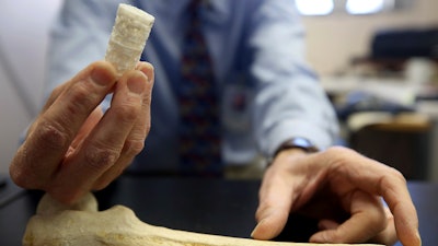 In this Dec. 17, 2018 photo, John Szivek, Rubin chair in orthopedic research professor at the University of Arizona, holds a scaffold and explains how it can help to regrow bone in Tucson, Ariz. Szivek received a $2 million grant from the U.S. Department of Defense to develop technology that could help military personnel recover from bone-shattering injuries using a 3D printer and adult stem cells.