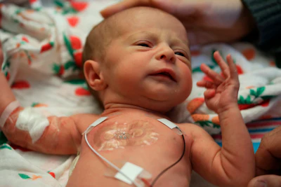 This 2019 photo provided by Northwestern University shows a soft, flexible wireless sensor applied on the chest of a family’s baby, who is involved in the clinical trial at Ann & Robert H. Lurie Children's Hospital of Chicago. This kind of sensor could replace the tangle of wire-based sensors that currently monitor babies in hospitals' neonatal intensive care units.