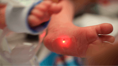 This 2019 photo provided by Northwestern University shows a soft, flexible wireless sensor applied on a foot of a family's baby, who is involved in the clinical trial at Ann & Robert H. Lurie Children's Hospital of Chicago. This kind of sensor could replace the tangle of wire-based sensors that currently monitor babies in hospitals' neonatal intensive care units.