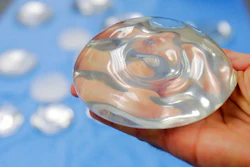 This Dec. 11, 2006 file photo shows a silicone gel breast implant in Irving, Texas. U.S. health officials are taking another look at the safety of breast implants, the latest review in a decades-long debate. At a two-day meeting that starts Monday, March 25, 2019, a panel of experts for the U.S. Food and Drug Administration will hear from researchers, plastic surgeons and implant makers, as well as from women who believe their ailments were caused by the implants.