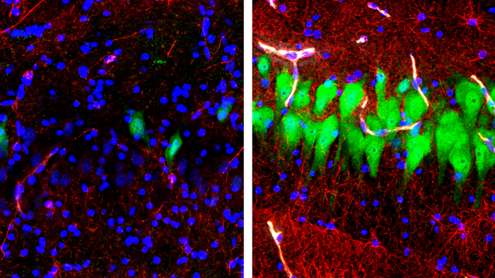 This combination of images provided by the Yale School of Medicine in April 2019 shows stained microscope photos of neurons, green; astrocytes, red, and cell nuclei, blue, from a pig brain left untreated for 10 hours after death, left, and another with a specially designed blood substitute pumped through it. By medical standards “this is not a living brain,” said Nenad Sestan of the Yale School of Medicine, one of the researchers reporting the results Wednesday, April 17, 2019, in the journal Nature. But the work revealed a surprising degree of resilience within a brain that has lost its supply of blood and oxygen, he said.