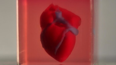 A 3D-printed, small-scaled human heart engineered from the patient's own materials and cells.