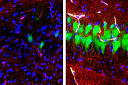 This combination of images provided by the Yale School of Medicine in April 2019 shows stained microscope photos of neurons, green; astrocytes, red, and cell nuclei, blue, from a pig brain left untreated for 10 hours after death, left, and another with a specially designed blood substitute pumped through it. By medical standards “this is not a living brain,” said Nenad Sestan of the Yale School of Medicine, one of the researchers reporting the results Wednesday, April 17, 2019, in the journal Nature. But the work revealed a surprising degree of resilience within a brain that has lost its supply of blood and oxygen, he said.