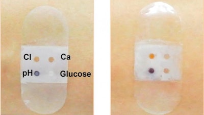 Biosensor bandage before (left) and after (right) sweat secretion.