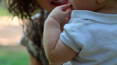 Angela Martínez holds her son Uriel as they walk in a park in Granada, south of Spain. Uriel's body is covered in hair due to taking a hair-growing medicine containing minoxidil, wrongly labeled as omeprazole.