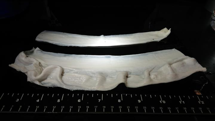 Gelatin fibers produced by 'immersion rotary jet spinning', a fiber production system inspired by cotton candy. These fibers form the 'base' to grow cells in — they mimic natural muscle tissue's extracellular 'glue', which holds the tissue together and contribute to its texture.