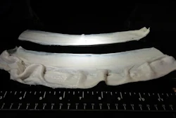 Gelatin fibers produced by 'immersion rotary jet spinning', a fiber production system inspired by cotton candy. These fibers form the 'base' to grow cells in — they mimic natural muscle tissue's extracellular 'glue', which holds the tissue together and contribute to its texture.