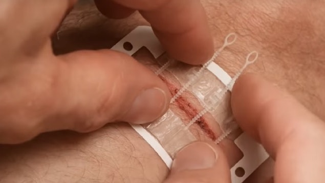 Would Closure Bandage Combo Helps Avoid Stitches From ZipStitch