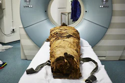 The mummified body of Nesyamun laid on the couch to be CT scanned at Leeds General Infirmary.
