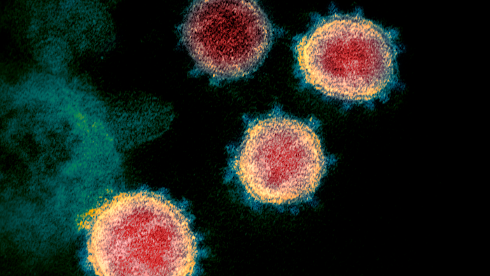 This undated electron microscope image made available by the U.S. National Institutes of Health in February 2020 shows the virus that causes COVID-19.
