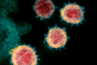 This undated electron microscope image made available by the U.S. National Institutes of Health in February 2020 shows the virus that causes COVID-19.