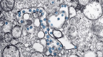 The coronavirus is simple biologically, but complicated in how it infects a host.