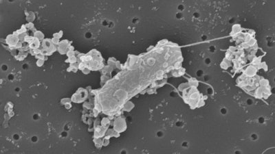 Electron microscopy image of biohybrid bacterial microswimmers.