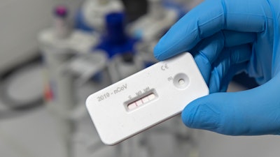 A scientist presents an antibody test for coronavirus in a laboratory of the Leibniz Institute of Photonic Technology (Leibniz IPHT) at the InfectoGnostics research campus in Jena, Germany, Friday, April 3, 2020.