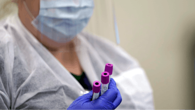 Julie Janke, a medical technologist at Principle Health Systems and SynerGene Laboratory, holds blood samples to be tested for COVID-19 antibodies Tuesday, April 28, 2020, in Houston. The company, which opened two new testing sites Tuesday, is now offering a new COVID-19 antibody test developed by Abbott Laboratories.