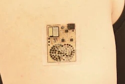 The sweat-powered biofuel cells in this electronic skin provide enough electricity to power biological sensors and transmit the information wirelessly to other devices.