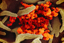 SARS-CoV-2 emerging from the surface of cells cultured in a lab.