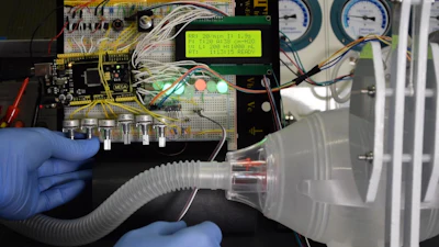 The ventilator is controlled by pressure sensors, rather than volume sensors, which allowed researchers to lower the device's price dramatically.
