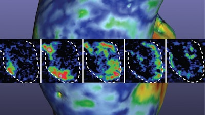 This image used on the cover of the American Heart Association's Circulation Research journal is a 3D rendering of the printed heart pump developed at the University of Minnesota.