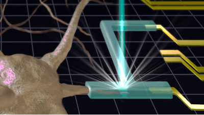 Illustration of a prospective biocompatible interface shows that hydrogels (green tubing), which can be generated by an electron or X-ray beam 3D printing process, act as artificial synapses or junctions, connecting neurons (brown) to electrodes (yellow).