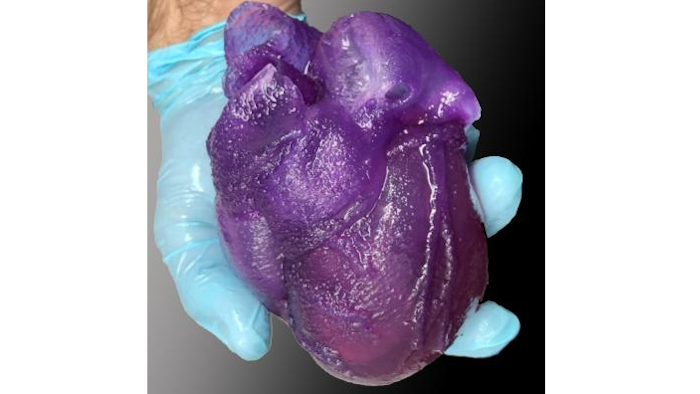 A 3D bioprinted heart model developed by Adam Feinberg and his team.