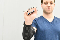 Moritz Graule, a graduate student at SEAS, demonstrates a fabric arm sleeve with embedded sensors.