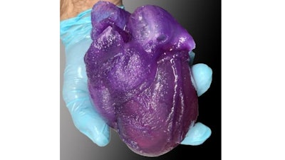 A 3D bioprinted heart model developed by Adam Feinberg and his team.