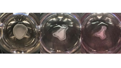 The three images, from left to right, show sequential growth of liver tissue on a plate of nutrient rich gel over the course of about 15 days. As the tissue matures, it shrinks, self-organizes and contracts. These livers were then transplanted into mice with liver disease. Velazquez et al. Cell Systems, CC BY-SA