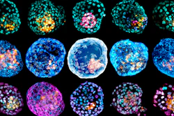 Combination of microscope images showing different 'iBlastoids' stained to highlight different cell types.